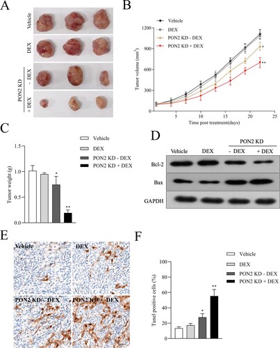 Figure 5. Downregulation of PON2 raises the curative effect of DEX on ALL cell growth in nude mice. (a) Images of tumors from nude mice in four groups. (b) Parental or sh-PON2 stable transfected REH cells were injected subcutaneously into nude mice. After injection, mice were treated with the vehicle or 15 mg/kg DEX. Tumor volume was measured on every three days. (c) Average tumor weight was measured after sacriﬁcing mice on the 21 days after treatment. (d) Bcl-2 and Bax expression in the four groups was detected by Western blotting. (e) TUNEL analysis in the four groups was detected by immunohistochemistry. (f) Histograms represent the percentage of TUNEL positive cells in different treatment groups. *P < .05, **P < .01 compared with vehicle.