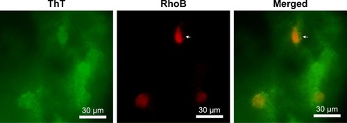 Figure 7 Fluorescent microscope images of PC12 cells embedded in RADA16 nanofiber scaffold. Arrows indicate cells beginning to stretch out and intrude into the surrounding scaffold.Abbreviations: RhoB, Rhodamine B; ThT, thioflavin-T.