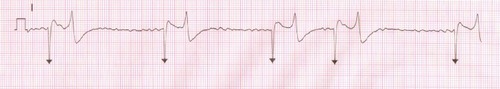 Figure 2 Electrocardiogram recorded from a horse in atrial fibrillation.