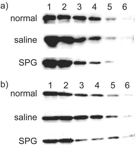 Figure 8.  CYP2E1 protein expression in liver microsomes from SPG-administered mice. Five-week-old ICR mice (A) and eight-week-old C3H/HeJ mice (B) were administered SPG (100 μg/mouse) or saline IP on Days -5, -3, and -1. On Day 0, liver microsomes were obtained and CYP2E1 protein expression was measured by Western blotting. Lane 1, 500 μg/ml; Lane 2, 250 μg/ml; Lane 3, 125 μg/ml; Lane 4, 62.5 μg/ml; Lane 5, 31.25 μg/ml; Lane 6, 15.625 μg/ml.