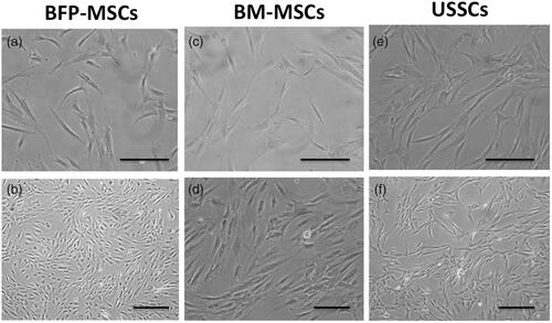 Figure 2. Stem cell images at two magnifications ×10 and ×40, BFP-MSCs (a, b), BM-MSCs (c, d) and USSCs (e, f) at passages two while cultured on tissue culture polystyrene (TCPS) under DMEM supplemented with FBS 10%.
