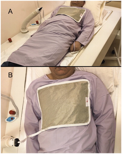 Figure 2. Placement of hyperthermia electrode. View from left (A) and above (B).
