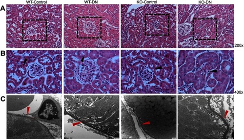 Figure 2 Representative images of renal histopathological change and tubular basement membrane. (A and B) Histopathological change in three groups (WT-control, WT-DN and KO-DN) at four weeks visualized by HE staining (A): Mild glomerulomegaly and brush border damage in proximal tubular epithelial cells, as typically for diabetic nephropathy, were shown in the WT-DN group while not in the WT-control group (P=0.023). Compared to the WT-DN mice group, KO-DN developed more severe glomerulomegaly (P=0.003), renal tubular hypertrophy and vacuolization (Original magnification =200×, 400× magnification reveals glomerulus and proximal renal tubule in black boxed area in 200×. Bar width =200 μm). The black arrows in panel B indicates P=0.023 (WT-DN VS WT-Control), P=0.003 (KO-DN VS KO-Control), P=0.005(KO-DN VS WT-DN). (C). Electron microscopy showed the typical changes in the early stage of DN that is thickening of the renal tubular basement membrane. The thickness in control groups was 110–130 nm, and that in groups with DN was 220–280 nm (Original magnification =25000×. Bar width =500 nm). The red arrows showed the tubular basement membrane.