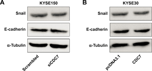 Figure S2 Expression of Snail and E-cadherin in ESCC cells after transfected with siCDC7 or pcDNA3.1-CDC7.Notes: (A) KYSE150 cells were transfected with siCDC7 for 48 hours, Western blotting were performed to assess the effect of EMT. (B) KYSE30 cells were transfected with pcDNA3.1-CDC7 for 48 hours, Western blotting were performed to assess the effect of EMT.Abbreviations: EMT, epithelial-to-mesenchymal transition; ESCC, esophageal squamous cell carcinoma.
