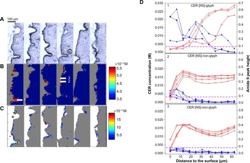 Figure 2 Spatial distribution and concentration of N-palmitoyl-D-erythro-sphingosine (CER [NS]-d31) penetration in skin. (A) Visible micrographs of microtomed skin sections (stratum corneum [SC] on the left side of each section). (B) Infrared (IR) images (of the same sections) of CER [NS]-d31 concentration. The concentration range of 3.5–5.5×10−3 M is shown to highlight the distribution of CER [NS]-d31. The area outside the skin is shown in gray. (C) IR images of CER [NS]-d31 concentration above detection limit (±1 standard deviation). The concentration below the detection limit is shown in gray. The area outside the skin is shown in white. (D) Line plots of ceramide concentration and Amide II peak height were compared between glyph and non-glyph regions labeled in B; three to five adjacent lines of pixels are shown.