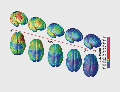 Figure 1. Gray matter maturation between ages 5 and 20. The side bar shows a color representation in units of gray matter volume. Images are stills from a movie available online from ref 1: Gogtay N, Giedd JN, Lusk L, et al. Dynamic mapping of human cortical development during childhood through early adulthood. Proc Natl Acad Sci U S A. 2004;101:8174-8179. Copyright © National Academy of Sciences 2004