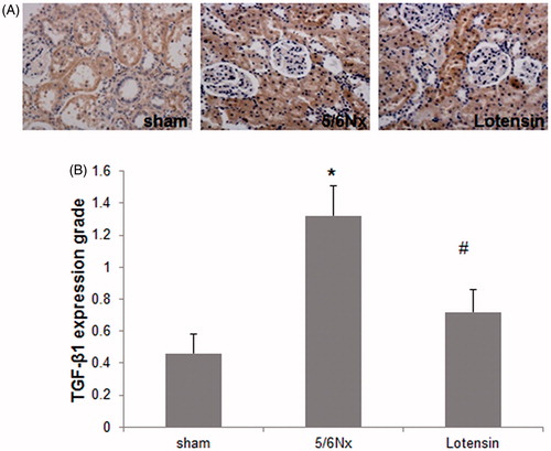 Figure 2. Effect of lotensin on TGF-β1 expression in renal epithelium. (A) Immunohistochemical staining of TGF-β1 (×200); (B) Quantification of the staining of TGF-β1; *p < .05 vs. the sham group; #p < .05 vs. the 5/6 Nx group (n = 10).