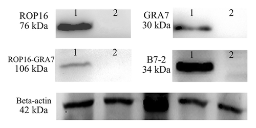 Figure 2. Western blotting analysis of the expression protein in vitro using anti-STAg mouse sera or anti-B7-2 antibody as primary antibody. β-actin serves as a loading control and from the left side there were lysates of HEK293T cells transfected with pEGFP, pROP16, pGRA7, pROP16-GRA7 or pB7-2 recombinant plasmid incubated with the same anti-β-actin antibody.