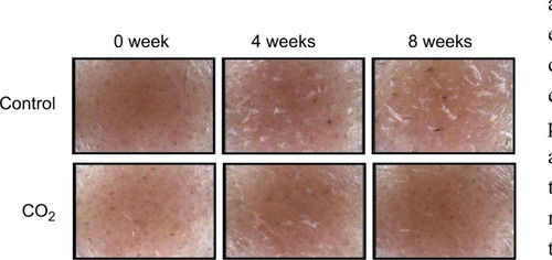 Figure 3 Changes in skin surface appearance.