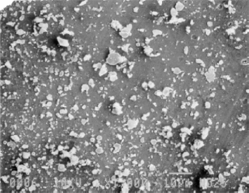 Figure 1. Scanning electron micrograph of iron-carbon microparticles prepared by FeRx for magnetic targeting of doxorubicin and other chemotherapeutics. 300 × magnification. Reprinted with permission from Elsevier from Biomaterials 21 (2000) 1411–1420.