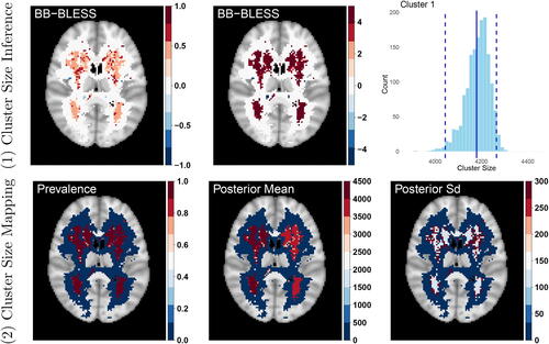 Fig. 6 (1) Cluster Size Inference: Top left: Raw age effect size image. Top middle: Test statistic map for age effect. Top right: Cluster size distribution for the largest cluster detected by a cluster defining threshold of 2.3 (The solid line indicates the observed cluster size from BLESS-VI and the dashed lines signify the 95% credible interval of cluster size.). (2) Cluster Size Mapping: Lower left, middle, right: Prevalence, posterior mean and posterior standard deviation map of cluster size, where the latter two statistics are determined for instances where the prevalence map exceeds a probability of 50%. The prevalence map here indicates that both clusters have reliably large effects with values close to 1.