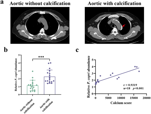 Figure 2. Correlation analysis of the prevotella copri (P. copri) abundance with calcification scores in chronic kidney disease (CKD) patients. (a) Aortic calcification in CKD patients was detected by computed tomography scan. (b) Relative abundances of P. copri in faeces. (c) Spearman’s correlation analyses of the association between P. copri in feces with calcification scores. Data are expressed as mean±SD, n = 18 per group. ***p < .001 by Student’s t-test.