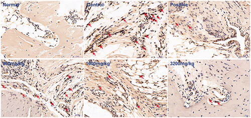 Figure 5. Effects of GSZD on the changes in osteoclasts of the ankle joint of CIA rats detected by TRAP staining (arrows indicate osteoclasts).