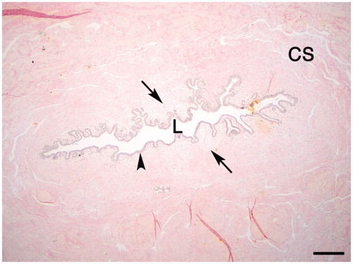 Figure 2. Van Gieson-stained normal urethra from a control tissue in low-power magnification. L, urethral lumen; arrowhead, epithelium; arrows, loose connective tissue; CS, corpus spongiosum. Scale bar = 500 μm.