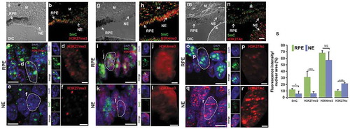 Figure 7. Re-patterning of histone modifications during RPE reprogramming to NE. Immunofluorescence staining and high-resolution three-dimensional (HR-3D) reconstruction confocal microscopy of histone modifications (b-f) H3K27me3 (red), (h-l) H3K4me3 (red), (n-r) H3K27Ac (red) along with 5mC (in green) at 3d PR in presence of FGF2. Single channels and merged views of the marked areas with dotted lines are shown for each combination of marks. HR-3D reconstruction confocal microscopy images of RPE, pigmented areas in a, g and m, are shown in c, i and o, respectively. All images were processed in parallel and imaged using the same confocal settings. Differential interference contrast (DIC) was used to illustrate the pigmented RPE in a, g and m. DAPI (blue), was used for nuclear counterstaining. M: mesenchyme; RPE: Retinal Pigment Epithelium; NE: neuroepithelium. Scale bar in n is 50 µm and applies to panels a, b, g, h, and m. Scale bar in c, e, i, k, o, and q is 5 µm. Scale bar in d, f, j, l, p, and r is 1 µm. (s) Quantification of the percentage of fluorescence intensity per nuclear area of histone modifications and 5mC. * = p < 0.05, *** = p < 0.001. NS, non-significant. Student’s t test. Means ± standard error is shown.