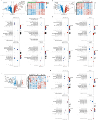 Figure 1 Analysis of DEGs during the development of NE-BE-EAC. (A) The limma package of R software was used to identify DEGs between NE and BE based on RNA-seq data of 94 NE tissues and 113 BE tissues from the GEO database. (B) The ClusterProfiler package in R software was used to perform GO analysis and KEGG analysis of up- and down-regulated DEGs. Similarly, DEGs between NE and EAC were analyzed based on RNA-seq data of 94 NE tissues and 147 EAC tissues in the GEO database (C), And the GO and KEGG analysis were performed using ClusterProfiler package in R software (D). Based on the RNA-seq data of 113 BE tissues and 147 EAC tissues in the GEO database, the DEGs between BE and EAC were analyzed (E), and the GO and KEGG analysis were performed using ClusterProfiler package in R software (F).