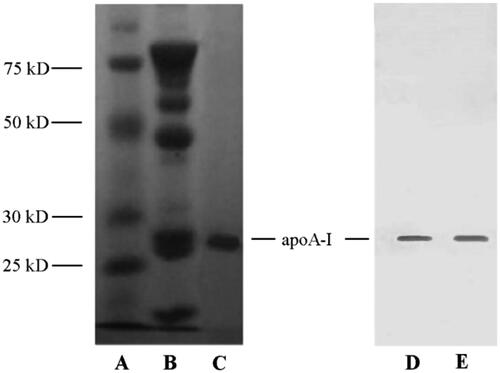 Figure 2. SDS-PAGE (left) and Western blot (right) patterns of samples. (A) Marker; (B) FIV precipitate; (C, D) extracted products; (E) standardized apoA-I.