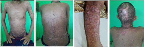 Figure 6 Clinical presentation of patient after 15 days of hospitalization (November 23, 2021).