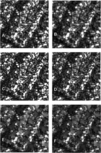 Figure 10. Examples of geometric/statistical resampling kernels applied to Radarsat-2 SAR ultra-fine mode (U2) image during the ortho-rectification process with DEM. The sub-images are 265_262 pixels with 0.5-m spacing. Letters A, B, C and D refer to geometric resampling kernels (nearest neighbour, bilinear, cubic convolution, sin(x)/x with 16_16 window), respectively, and letters E and F refer to statistical adaptive SAR filters (Enhanced Lee and Gamma with 5_5 window), respectively. ‘Radarsat-2 Data_ MacDonald, Dettwiler and Associates Ltd. (2008) - All Rights Reserved’ and Courtesy of Canadian Space Agency.