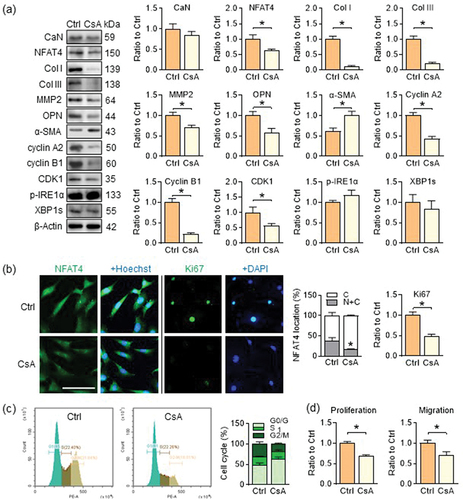 Figure 4. CaN inhibitor CsA suppresses the activation of NFAT4 and inhibits PASMC phenotypic transition in SKI PASMCs. (a) Representative western blots of SKI PASMCs treated with CsA, and quantification of band intensities in the graph. (b) Representative images of NFAT4 (green) and Ki67 (green) immunofluorescence staining in SKI PASMCs treated with CsA, and quantitative the proportion of cells with NFAT4 in the nucleus or percentage of Ki67-positive (green) cells. Nuclei are indicated by DAPI (blue). (c) Representative cell cycle analyzed by flow cytometry (left), and the relative percentage of cells in each phase (right). (d) cell proliferation and migration. Data shown are means ± SEM. NFAT4 immunofluorescence staining, two-way ANOVA with Bonferroni’s multiple comparisons test; others, unpaired t test; *P < .05, CsA vs. solvent control (Ctrl); n = 5–7. (c), n = 3. Scale bar: 100 μm.