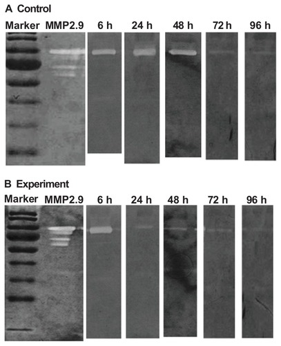 Figure 8 Variation in matrix metalloproteinase-9 (MMP-9) expression of the rabbit cornea at 6, 24, 48, 72, and 96 hours (h) during wound healing. SDS polyacrylamide gel electrophoretic analysis of tear samples from repairing cornea. Exp represents the experimental group (200 μg/mL mSC). Con represents the control group (phosphate-buffered saline). (A) MMP-9 expression of the experimental group (B) MMP-9 expression of the control group.