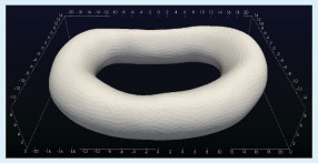 Figure 4. The final smoothed 3D model of the L1–L2 intervertebral disc of the patient.The numbers correspond to millimeter.