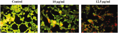 Figure 5. Effect of gold nanoparticles from C. militaris induces apoptotic morphological changes in HepG2 cells. The untreated cells showed the absence of apoptosis by observing green fluorescence staining. 10 µg and 12.5 µg/ml illustrates that the gold nanoparticles treatment significantly increased the apoptotic cells by observing orange fluorescence staining in HepG2 cells.