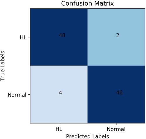 Figure 9 Confusion matrix of attention deep learning algorithm.Abbreviation: HL, Hyperlipidemia