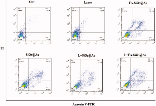 Figure 9. FITC-labeled Annexin V apoptosis assay in the FR-positive A375 cells. (A) Untreated control cells, (B) Treated cells by laser alone, (C) Treated cells by FA- SiO2@Au nanoparticles, (D) Treated cells by SiO2@Au nanoparticles, (E) Treated cells by Laser combined with SiO2@Au nanoparticles, (F) Treated cells by Laser combined FA- SiO2@Au nanoparticles. Abbreviations: Q1: necrosis cells; Q2: late apoptosis cells; Q3: early apoptosis cells; Q4: live cell.