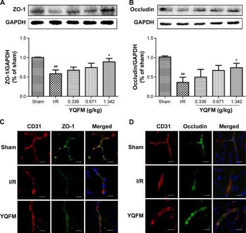 Figure 6 Effect of YQFM on the expression of tight junction proteins in mice with cerebral I/R.