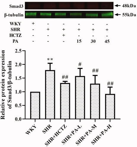 Figure 8. Effect of phenylacetamide on Smad3 the in hearts of SHR rats. The value of the WKY group was set at 1, and the relative value was presented as fold induction to that of the WKY group. Values are expressed as the mean ± SD of 3 samples. *p < 0.05, **p < 0.01 vs. WKY group; #p < 0.05, ##p < 0.01 vs. SHR group.