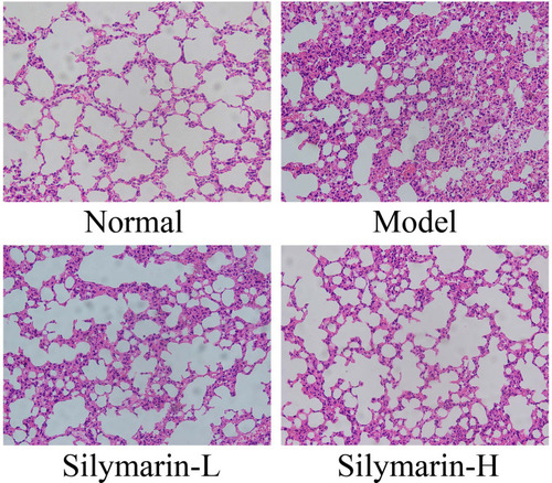 Figure 3 H&E pathological staining structure of lung tissues. Model: treated with D-Gal/LPS (30 mg/kg·bw/3 μg/kg·bw) intraperitoneal injection; silymarin-L: treated with silymarin (75 mg/kg·bw) intragastric administration; silymarin-H: treated with silymarin (150 mg/kg·bw) intragastric administration.