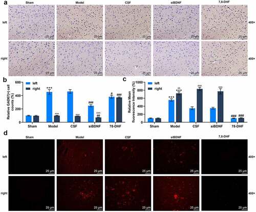 Figure 6. The BDNF/TrkB signaling pathway influenced the number of GABAergic neurons and GABAAR expression in the left (lesioned) side and right (intact) side of MVN. (a) Photomicrographs showing GAD67 immunostaining in the left (lesioned) side and right (intact) side of MVN 7 d after unilateral labyrinthectomy with continuous drug infusion in the fourth ventricle (artificial CSF, siBDNF, or 7, 8-DHF). (b) The relative GAD67-positive cells for Figure 6a. (c and d) Photomicrographs showing GABAAR immunostaining in the left (lesioned) side and right (intact) side of MVN 3 d after unilateral labyrinthectomy with continuous drug infusion in the fourth ventricle (artificial CSF, siBDNF, or 7, 8-DHF). CSF, cerebrospinal fluid; 7,8-DHF, a TrkB Agonist. *** p < 0.001 vs. counterparts in Sham; ^^ p < 0.01 or ^^^ p < 0.001 vs. left side; # p < 0.01 or ### p < 0.001 vs. counterparts in CSF