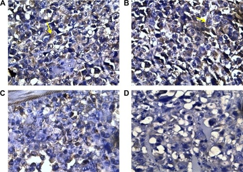 Figure 2 Cytoplasmic VEGF staining in tumor sections from different groups.