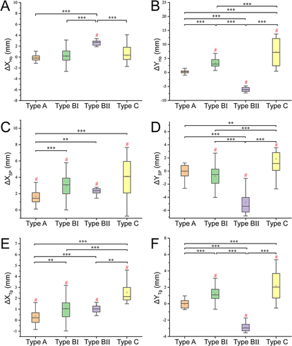 Figure 4 Dynamic characteristics of the displacement of each tissue centroid during airway obstruction of type A, BI, BII, and C. (A and B) ΔXHo and ΔYHo, displacement of the hyoid center in the X-direction and Y-direction. (C and D) ΔXSP and ΔYSP, displacement of the soft palate center in the X-direction and Y-direction. (E and F) ΔXTg and ΔYTg, displacement of the tongue center in the X-direction and Y-direction. The hash #Indicates that the change of the centroid location itself during airway obstruction is significant, p-value < 0.05. The asterisk indicates that the displacement with different types of obstruction is significantly different. **p-value <0.01, ***p-value <0.001.