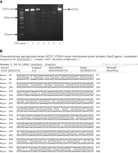 Figure 4 Analysis of partial sequence of OprD2 gene from clinical isolates. (A) Electrophoresis of PCR products for OprD2. Lane 1, 2, 3 and 7: CRPA43, CRPA 52, CRPA 56 and. CRPA 60 isolates with OprD2 PCR products (1332 bp); Lane 4, 5, 6: CRPA01, CRPA02, and CRPA03 isolates without OprD2 PCR products (1332 bp). (B) BLAST of OprD2 PCR products against P. aeruginosa standard strain ATCC27853.