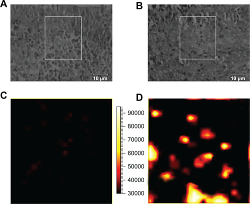 Figure S3 (A) and (B) Bright field images of a region from normal and cancerous nasopharyngeal tissue sections, respectively; (C) and (D) demonstrate surface-enhanced Raman scattering images of normal tissue and cancerous tissue, respectively. The surface-enhanced Raman scattering images were acquired by scanning the laser beam to cover the white boxes in (A) and (B), respectively.