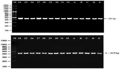 Figure 2 Electrophoresis shows a single band of amplified DNA at 456 bp (A) and 415 bp (B), as specified by the primers. Note: (M) 100 bp marker; 18: patient with ANB=4.91°; 25: patient with ANB=7.5°; 26: patient with ANB=6.81°; 27: patient with ANB=6.1°; 28: patient with ANB=7.65°; 29: patient with ANB=7.08°; 30: patient with ANB=6.58°; 31: patient with ANB=9.42°; 32: patient with ANB=6.48°; A-E: patient with ANB<4°.