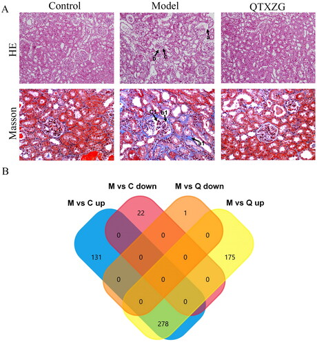 Figure 1. Proteomic analysis of glomerular tissue in adriamycin-induced rats. (A). HE and Masson’s staining were used to observe pathological changes in glomerular tissue (200 ×). a: Glomerular basement membrane thickening; b: glomerular atrophy and deformation; c: inflammatory cell infiltration. a1: collagen deposition; b1: glomerular basement membrane thickening; c1: glomerular atrophy and deformation. (B). Venn diagram of differentially expressed proteins (DEPs) coregulated in the model (M) and QTXZG (Q) groups.