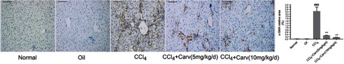 Figure 2 The expression of α-SMA was detected by immunohistochemical staining (magnification ×200). Scale bars: 100 μm. Carvedilol effectively inhibited the expression of α-SMA. ###P<0.001 vs oil group; **P<0.01 vs CCl4 group; P<0.01 CCl4+Carv (5 mg/kg/d) group vs CCl4+Carv (10 mg/kg/d) group.
