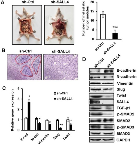 Figure 6 SALL4 knockdown inhibits the peritoneal metastasis of gastric cancer in vivo.Notes: (A) The number of metastatic tumor nodes in the abdomen of mice from the control and SALL4 knockdown groups. (B) H&E staining of liver tissues in mice from the control and SALL4 knockdown groups. (C) qRT-PCR analyses of EMT markers in mouse metastatic tumor nodules from the control and SALL4 knockdown groups. (D) Western blot assays for EMT marker and SMAD2/3 expression in mouse metastatic tumor nodules from the control and SALL4 knockdown groups. *P<0.05, **P<0.01, ***P<0.001.Abbreviations: EMT, epithelial–mesenchymal transition; H&E, hematoxylin and eosin; qRT-PCR, quantitative real-time PCR.