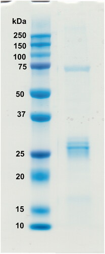 Figure 4. Recombinant GsaCAβ protein analysed on SDS-PAGE. The image shows protein ladder standards (left) and the purified recombinant G. salaris β-CA protein (right) showing a molecular mass calculated from mobility of 26.0 kDa.