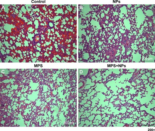 Figure 3 Se@SiO2 nanocomposites did not reduce the injury of MPS on lung tissue. Compare to the control (A), both NPs (B) and MPS (C) can decrease the inflammatory response in lung. The combine use of NPs and MPS (D) have no significant difference to MPS group (C).Notes: Histologic analysis of rat lung tissues. The rat lung tissues were stained with H&E.Abbreviations: MPS, methylprednisolone; NPs, nanoparticles.