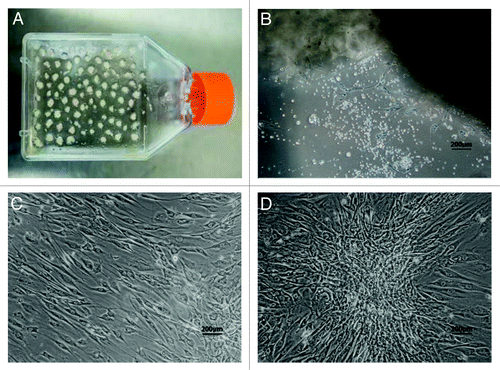 Figure 1. Isolation and primary culture of human ADSCs. The isolated process and primary culture of human ADSCs were described in the Materials and Methods. (A) The pieces of adipose tissue attached on the walls of culture flasks on the first day of culture. (B) The ADSCs demonstrated spindle-like morphology on the seventh day of culture. (C) The ADSCs with fibroblast-like morphology developed into 80–90% confluence after 10 d of primary culture. (D) One representative colony with sphere-like shape was observed in 2-week culture. Scale bars: 200 µm