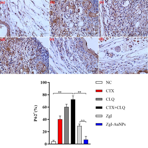 Figure 12 The immunohistochemical detection of P62 protein in haematopoietic stem cells. (A) The immunohistochemical images of P62 protein. (B) The statistical chart of P62 protein-positive cells. (a).NC group: saline. (b). CTX group:CTX + saline. (c). CLQ group: CLQ + saline. (d). CTX+CLQ group: CTX + CLQ + saline. (e). ZgI group: ZgI + CTX + CLQ + saline. (f).ZgI-AuNPs group: ZgI-AuNPs + CTX + CLQ + saline. Data are presented as mean ± SD from six independent experiments (vs CTX+CLQ group group, *P<0.05, **P<0.05; vs ZgI, ΔΔP < 0.01).