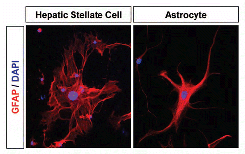Figure 1 Expression of GFAP in HSCs and astrocytes. Differentiation of HSCs into activated myofibroblasts (left) is a hallmark of fibrotic liver disease of different etiologies, such as viral hepatitis and chronic alcohol consumption.Citation96 In chronic liver disease, perpetuation of HSC activation leads to excessive collagen and ECM deposition, resulting in liver fibrosis. Thus, sustained activation of HSCs is a target for the treatment of liver fibrosis.Citation5 Astrocytes (right) become reactive in response to all forms of CNS injury or disease, causing cellular hypertrophy, scar formation and production of inhibitory CSPGs.Citation6,Citation7 CSPG removal from the injured CNS area offers promise for therapies to improve axonal regeneration after CNS injury.Citation94