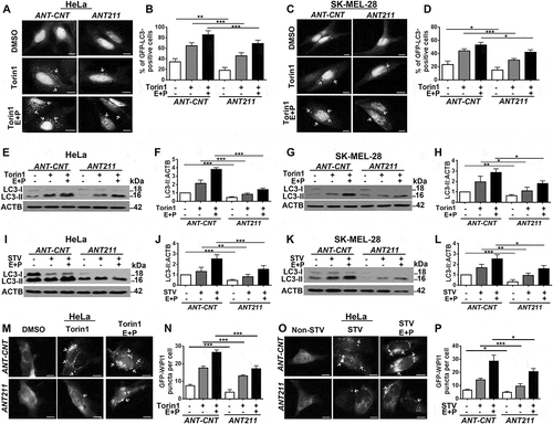 Figure 4. Antagomir-mediated inhibition of MIR211 led to the suppression of torin1- and starvation-induced autophagy. (a) Antagomir against MIR211 (ANT211), but not the control antagomir (ANT-CNT), decreased torin1-induced GFP-LC3 puncta formation in the presence or absence of lysosomal inhibitors E64D and pepstatin A (E + P) in HeLa cells. Scale bar: 10 µm. (b) Quantitative analysis of GFP-LC3 dots in the experimental set-up shown in A (mean± SD of n = 3 independent experiments, ***p < 0.01, **p < 0.03). (c) MIR211 knockdown by ANT211 decreased torin1-induced GFP-LC3 puncta formation compared to ANT-CNT control in SK-MEL-28 cells. Scale bar: 10 µm. (d) Quantitative analysis of GFP-LC3 dots in the experimental set-up shown in C (mean± SD of n = 3 independent experiments, ***p < 0.01, *p < 0.05). (e) Immunoblots of ANT-CNT- or ANT211-transfected HeLa cells that were treated with DMSO or torin1. (f) Graph depicting quantification of LC3-II:ACTB ratios in the experimental set-up shown in E (mean± SD, n = 3 independent experiments, ***p < 0.01). (g) Immunoblots of ANT-CNT- or ANT211-transfected SK-MEL-28 cells that were treated with DMSO or torin1. (h) Graph depicting quantification of LC3-II:ACTB ratios in the experimental set-up shown in G (mean± SD, n = 3 independent experiments, **p < 0.03, *p < 0.05). (i) Immunoblots of ANT-CNT- or ANT211-transfected and non-starved or starved (STV) HeLa cells. (j) Graph depicting quantification of LC3-II:ACTB ratios in the experimental set-up shown in I (mean± SD, n = 3 independent experiments, ***p < 0.01, **p < 0.03). (k) Immunoblots of ANT-CNT- or ANT211-transfected and non-starved or starved SK-MEL-28 cells. (l) Graph depicting quantification of LC3-II:ACTB ratios in the experimental set-up shown in K (mean± SD, n = 3 independent experiments, ***p < 0.01, **p < 0.03, *p < 0.05). (m) ANT211 blocked torin1-induced GFP-WIPI1 puncta formation in HeLa cells. Scale bar: 10 µm. (n) Quantitative analysis of GFP-WIPI1 puncta in the experimental set-up shown in M (mean± SD of n = 3 independent experiments, ***p < 0.01). (o) ANT211 blocked starvation-induced GFP-WIPI1 puncta formation in HeLa cells. Scale bar: 10 µm. (p) Quantitative analysis of GFP-WIPI1 dots in the experimental set-up shown in O (mean± SD of n = 3 independent experiments, ***p < 0.01, *p < 0.05).