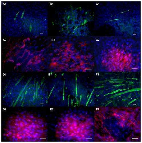 Figure 7 Immunochemistry staining after four days of culture on electrospun scaffolds. (A) 5PU, (B) SWNT-5PU, (C) MWNT-5PU, (D) 10PU, (E) SWNT-10PU, and (F) MWNT-10PU. (−1) represents myosin heavy chains in green and (−2) represents Myf-5 in red. Cell nuclei were stained with DAPI in blue.Note: Scale bars are 40 μm.Abbreviations: MWNT, multiwalled nanotubes; SWNT, single-walled nanotubes; 5PU, 5% w/v polyurethane; 10PU, 10% w/v polyurethane.