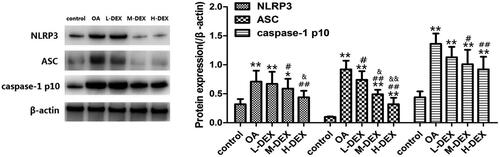 Figure 6. Effect of Dex on NLRP3 inflammatory bodies in OA rats. The expression levels of NLRP3, ASC and caspase-1 in cartilage tissues were detected by Western blotting. Values are means ± SD. N = 10. **p < 0.01 vs. control group; #p < 0.05, ##p < 0.01 vs. OA group; &p < 0.05, &&p < 0.01 vs. L-DEX group.
