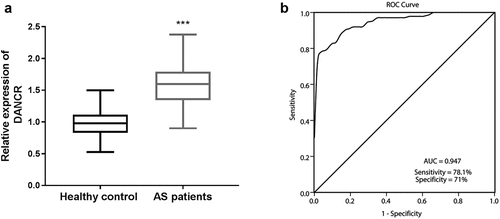 Figure 1. DANCR levels in the serum of patients with atherosclerosis. (a) The serum DANCR was highly expressed in the serum of patients with atherosclerosis compared to healthy controls. (P < 0.001). (b) ROC curve analysis showed that DANCR could distinguish patients with atherosclerosis from healthy individuals. The AUC was 0.947, a sensitivity of 78.1%, and a specificity of 71%.